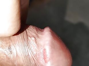  Injuries to the penis when i sex my boyfrend.
