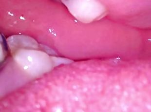 Inside my mouth with braces